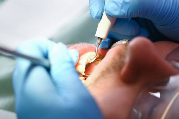 Best Broken or Chipped Tooth Repair in Neodesha, KS