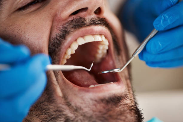 Best Emergency Treatment for Oral Infections in Neodesha, KS