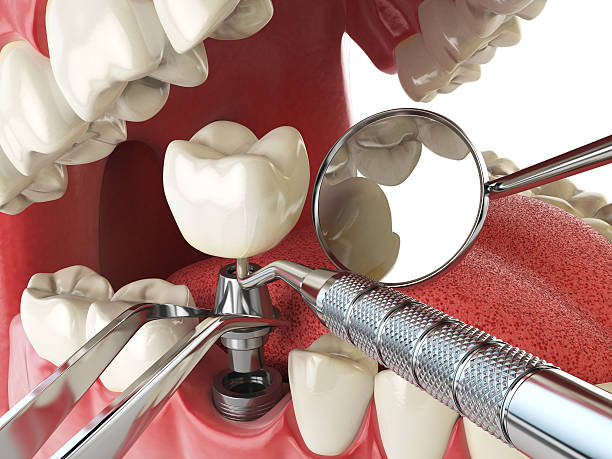 Best Emergency Dental Care for Sports Injuries in Neodesha, KS
